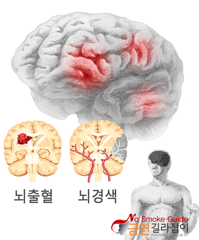 뇌 이미지