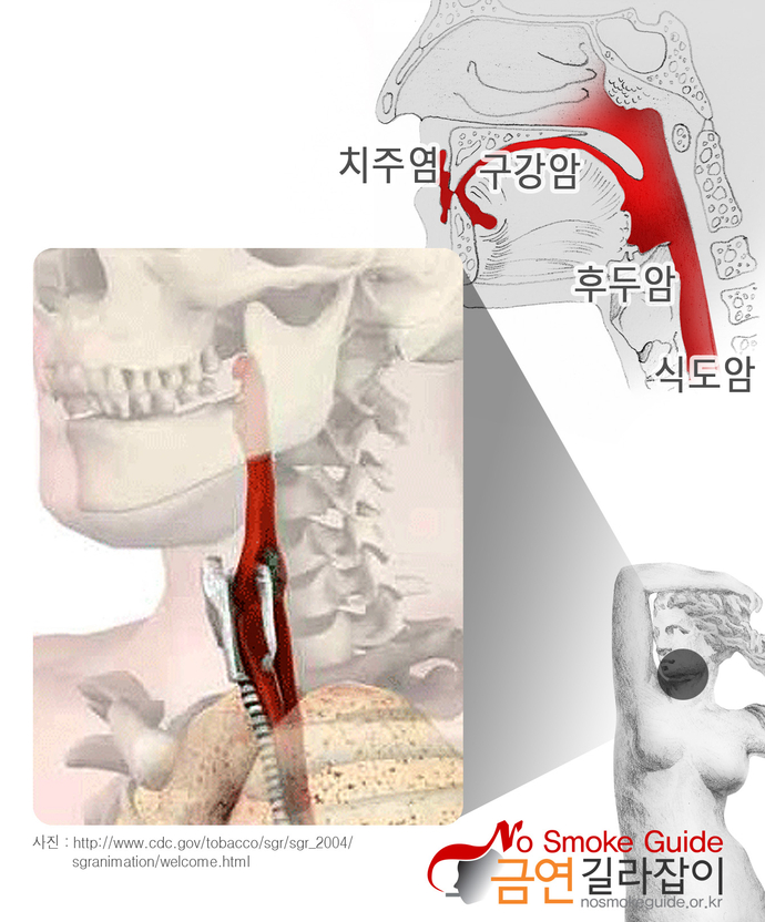 입/목구멍/후두/식도 이미지